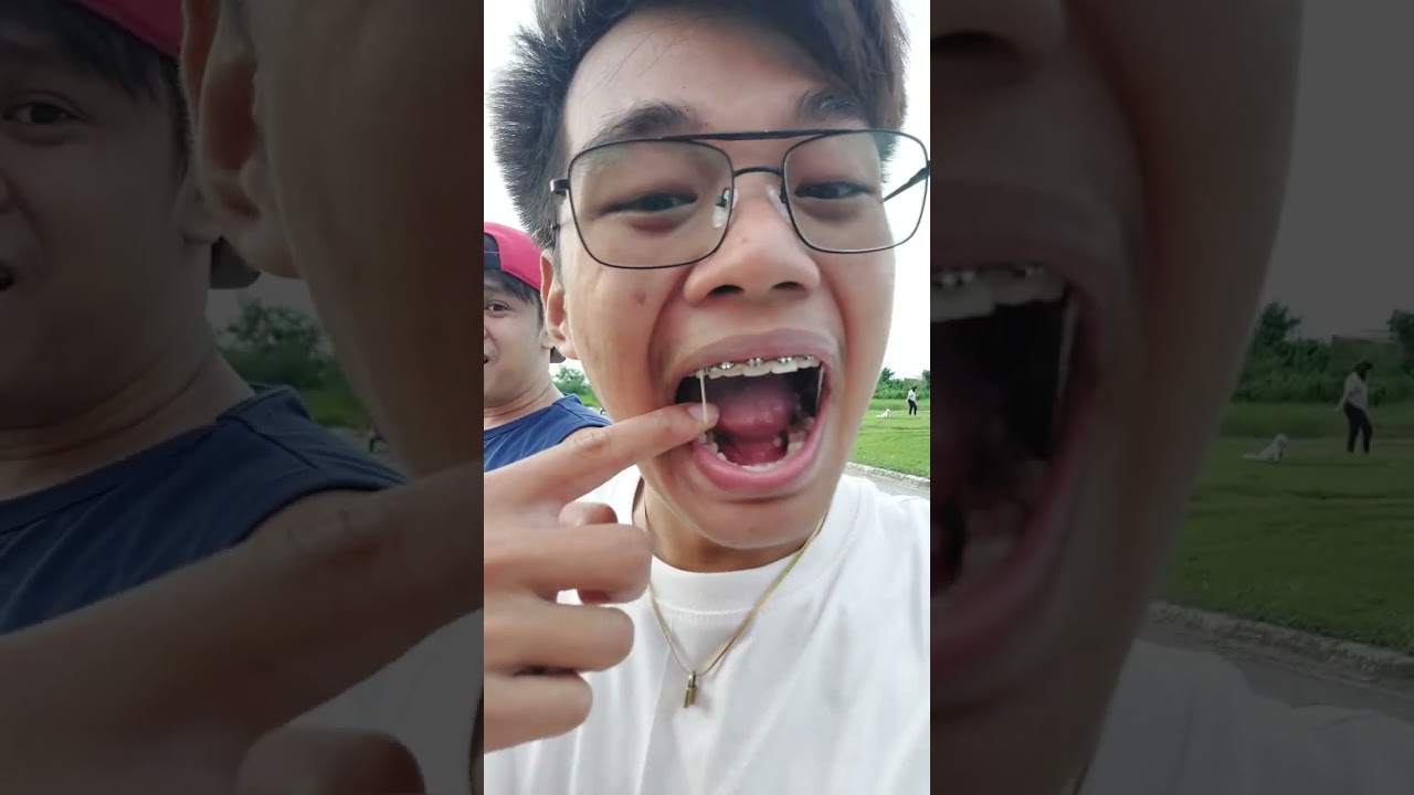 Galing talaga ng pandinig nila nakakakita sila palago ng may handaan