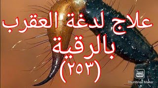 علاج لدغة العقرب بالرقية - الشيخ د. أسعد بن فتحي الزعتري سدده الله تعالى (٢٥٣)