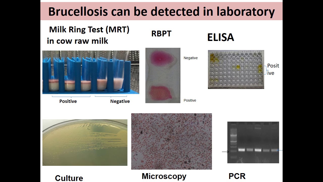 PDF) Milk Ring Test as Ready Aid to Diagnose Bovine Brucellosis in  Lactating Cows of Tamil Nadu, India