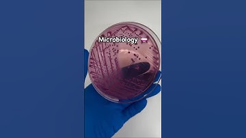 Microbiology #laboratory #science #laboratorytechniques #lab #biotech #microbiology