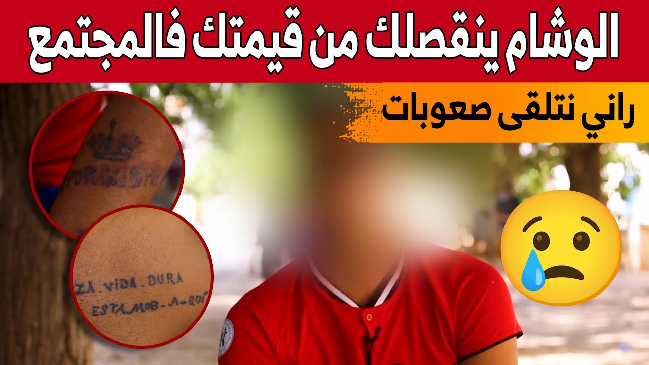 الوشم..  قصص ندم وأمل التخلص منه