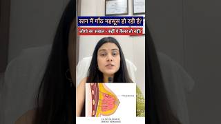 Breast lump | स्तन में गांठ | Fibroadenoma| ये कैंसर है या नहीं?| #shorts #healthtips #cancer #viral