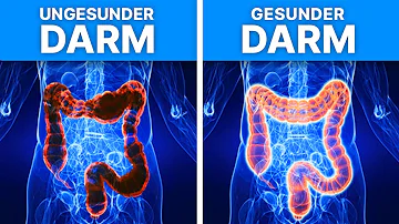 Welche Lebensmittel säubern den Darm?