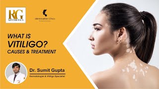 Vitiligo Management Dr. Sumit Gupta Skinnovation Clinics
