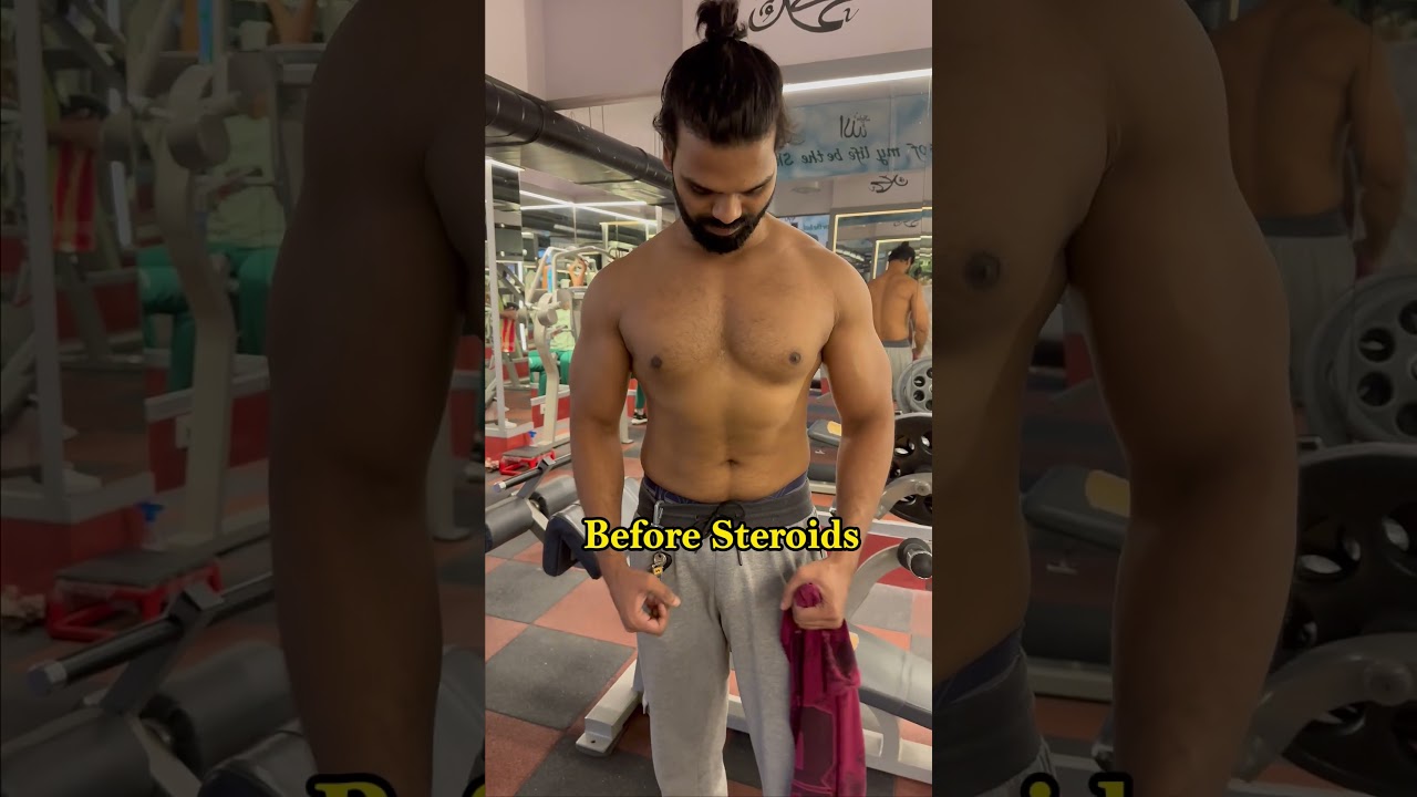 BEFORE STERIODE AND AFTER STERIODS ||#shortsfeed #shorts