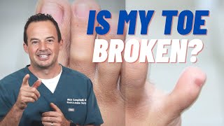 HOW CAN YOU TELL IF YOU BROKE YOUR PINKY TOE?! |Dr. Nick Campitelli