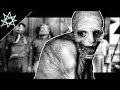 Russian Sleep Experiment Images | Explained