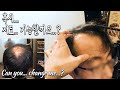 [SUB] 혹시.... 저도 가능할까요..?  숱없고, M자이마인데.. /Can I be young? For alopecia,  Widow's peak.[킹스턴맨즈헤어]