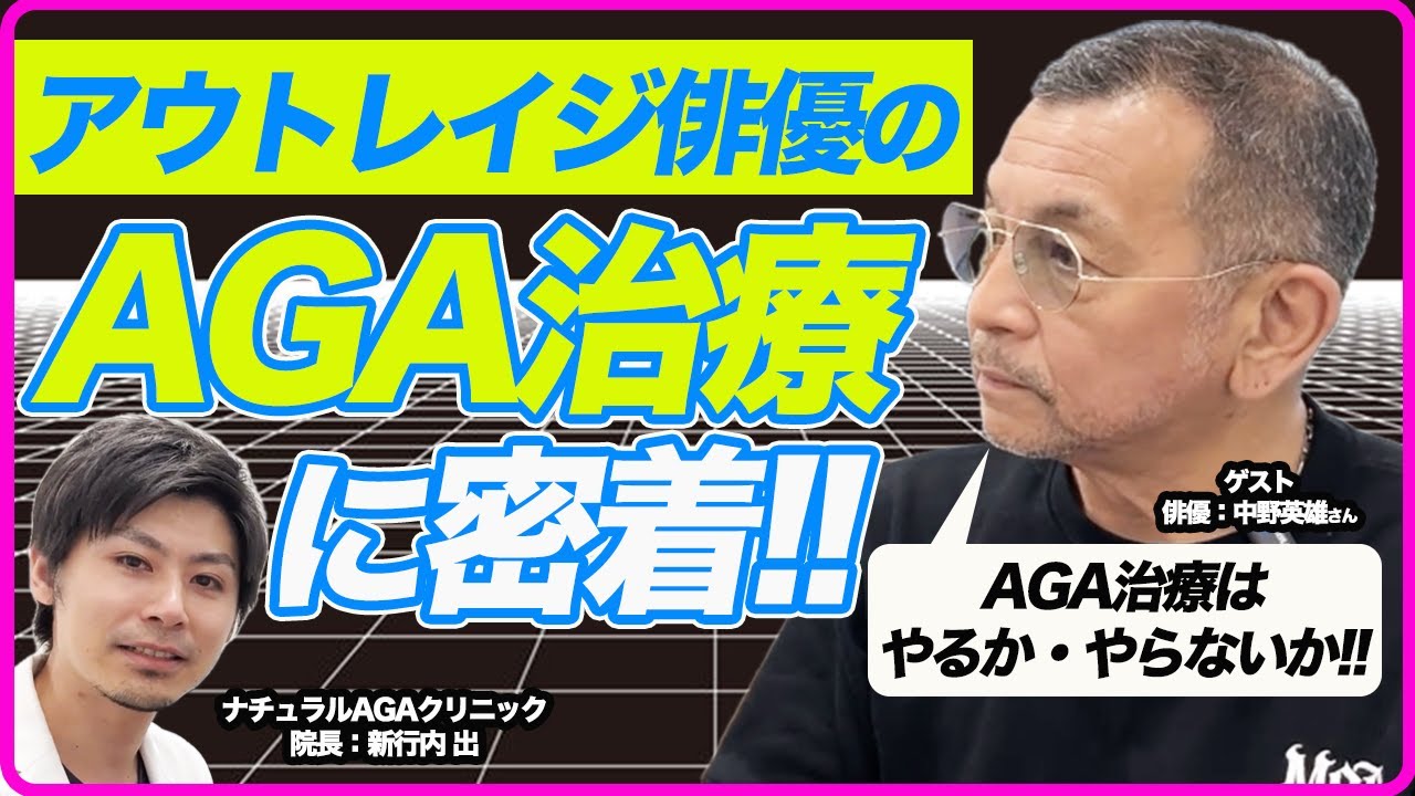 俳優 ハゲ