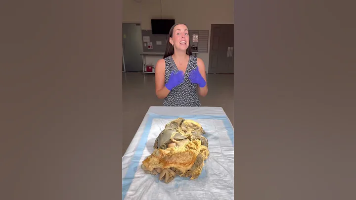 🧠🫁🫀👀 @experienceanatomy5197 #anatomy #humanbody #science #organs thumbnail