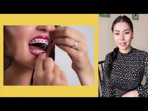 Видео: Шүдний хиймэл шүдийг хэрхэн зүүх вэ
