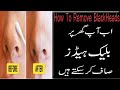 How to Remove Blackheads Naturally In Urdu In Hindi  By Herbalist