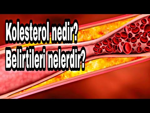 Kolesterol nedir? Belirtileri nelerdir?