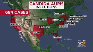 Researchers Learning More About Superbug Fungus Candida Auris