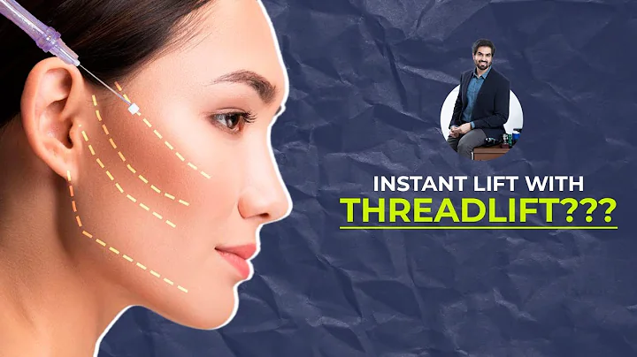 Do Thread Lifts Work? Thoughts of a Plastic Surgeon Reacts | Dr.OBT