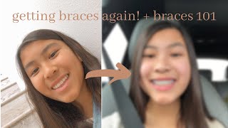 getting braces again! + braces 101