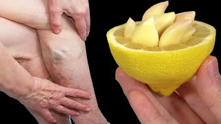 Leg pain, rheumatism, varicose veins, arthritis, headaches, joint pain Mama's natural remedies