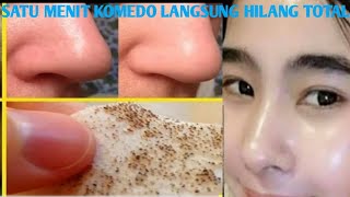 FACIAL DIRUMAH KOMEDO HILANG HANYA SEMENIT SAJA, WAJAH MULUS, GLOWING PUTIH & HALUS