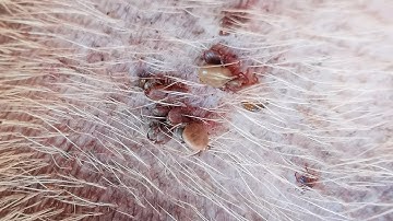 Dog Ticks Remove - Easy And Fast Way To Remove All Ticks From Poor Dog - Save Poor Dog EP 60
