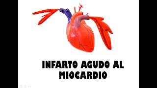 Acute Myocardial Infarction (AMI) QUICK REVIEW 2019