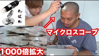 ハゲがマイクロスコープで頭皮環境チェックしてみた Youtube ハゲがマイクロスコープで頭皮環境チェックしてみた Youtube