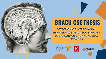 Detection of Intracranial Brain Hemorrhage | Brac University | CSE | Thesis | Deep Learning