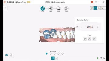 04 DEXIS IS ScanFlow_How to Scan Basic.