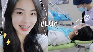 vlog48 我在上海戴牙套啦拔完牙出血進急診。牙套Q&A+VLOG