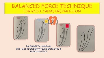 Balanced force technique tutorial| Curved molar root canals