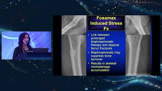 Prof.  Christine Chung - Metabolic bone diseases