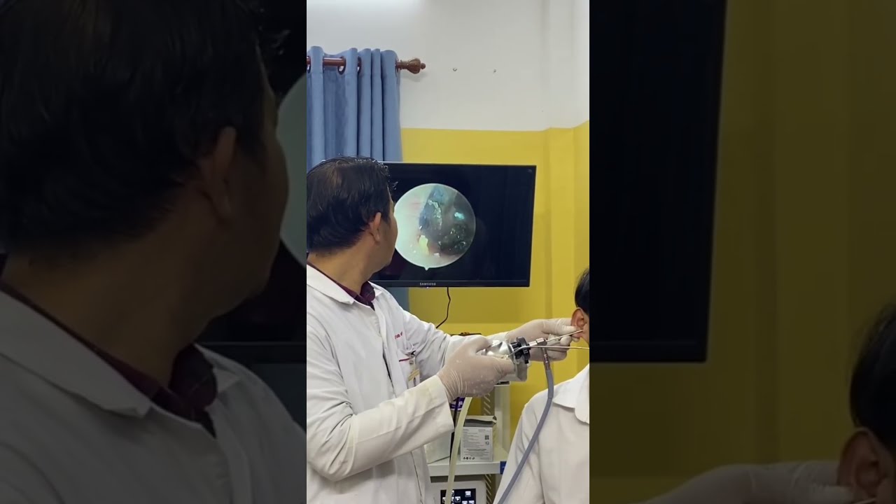 Endoscopic Ear Exam What S Hiding Inside MedicalVideo CleanEar ENT