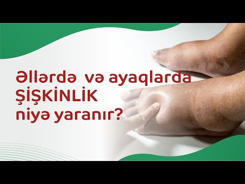 Video: Pəncə Ağacına Qulluq - Pəncə Ağacları üçün Artan Şərtlər