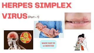 Herpes simplex virus | Part - 1| In just 10 minutes | Medinare