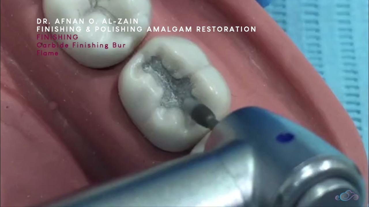 Finishing & polishing Class I amalgam restoration Arabic عربي YouTube