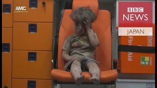 「21世紀のホロコーストだ」――シリア負傷男児手当てした医師