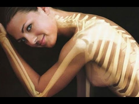 Video: Unterschied Zwischen Arthritis Und Osteoporose