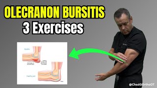 Exclusive 🦴 Olecranon Bursitis Treatment: Therapy Tips to Reduce Elbow Swelling & Pain Details