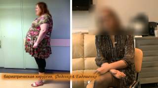 СЛИВ, продольная резекция желудка, рукавная гастропластика, похудение, отзыв СЛИВ, продольная резекция желудка, рукавная гастропластика, похудение, отзыв