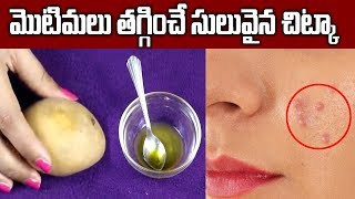 Potato Facial to remove Pimples, Dark spots, Skin Whitening || Beauty Tips || SumanTV Organic Foods