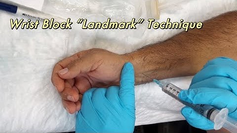 Wrist Block “Landmark” Technique by Henry Hu, MD