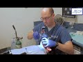 Jackson Rees (Mapleson F) circuit Nasal intubation in a dental office