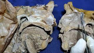 Nasal cavity and paranasal air sinuses