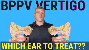 How to tell which ear to treat for BPPV (Using Half Somersault Maneuver)