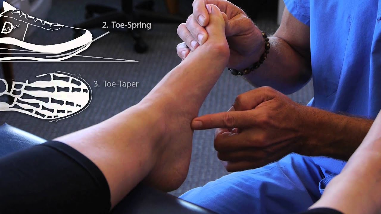 What is Plantar Fasciitis in Kansas City? - F.I.TMuscle & Joint Clinic