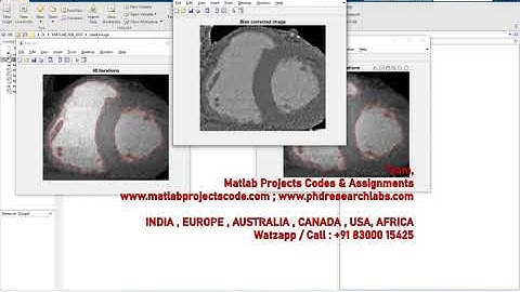 Heart image segmentation PH.D. RESEARCH SUPPORT | MATLAB PROJECTS | WWW.MATLABPROJECTSCODE.COM