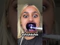 So wurden ihre Zähne komplett weiß 🦷 😁