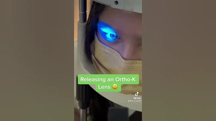 Releasing an ortho-K lens to a -5.00 myope! 😃 #orthokeratology #orthok #contactlenses #contactlens - DayDayNews