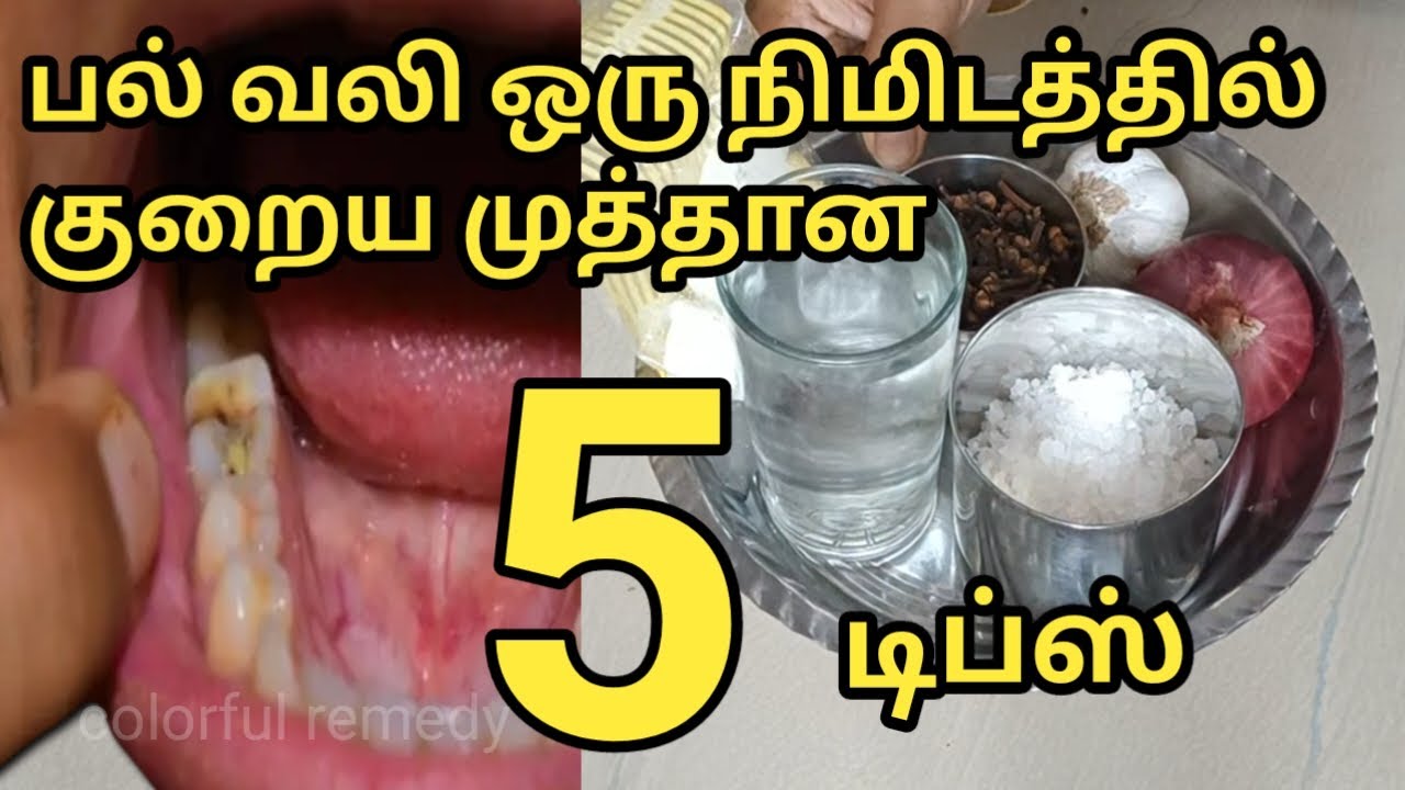 5 Best Home Remedies For Teeth Pain how To Control Teeth Pain In 1 5-best-home-remedies-for-teeth-pain-how-to-control-teeth-pain-in-1