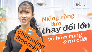 Bất ngờ trước kết quả niềng răng móm của cô nàng 21 tuổi