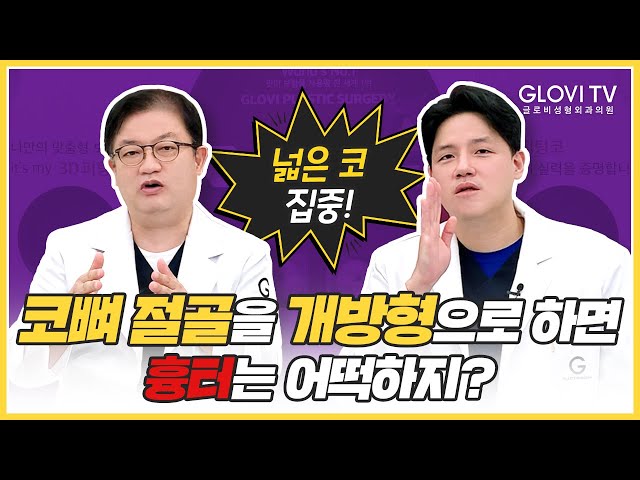 [글로비성형외과의원] #코뼈 절골을 "개방형"으로하면 흉터는 어떡하지?